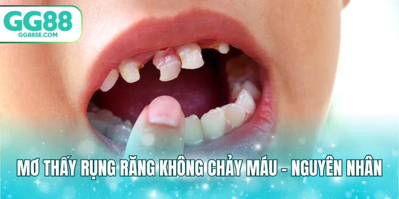 Mơ thấy rụng răng không chảy máu - Nguyên nhân